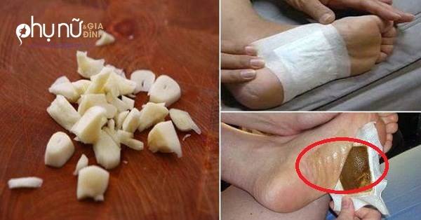 Giã nát tép tỏi đắp lên gan bàn chân rồi đi ngủ, kết quả sáng hôm sau khiến mọi người thực sự sốc!!!